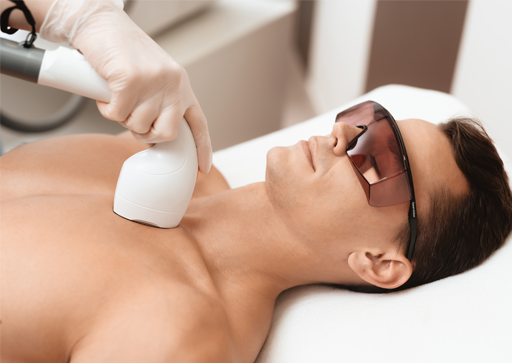 Laser Hair Removal